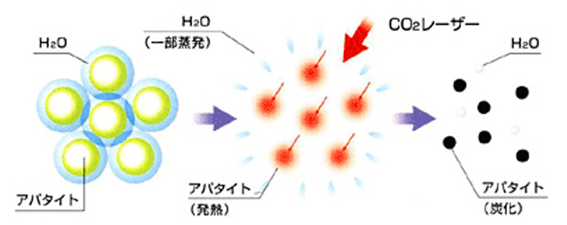 当院では炭酸ガス（CO2）レーザーを使用しています